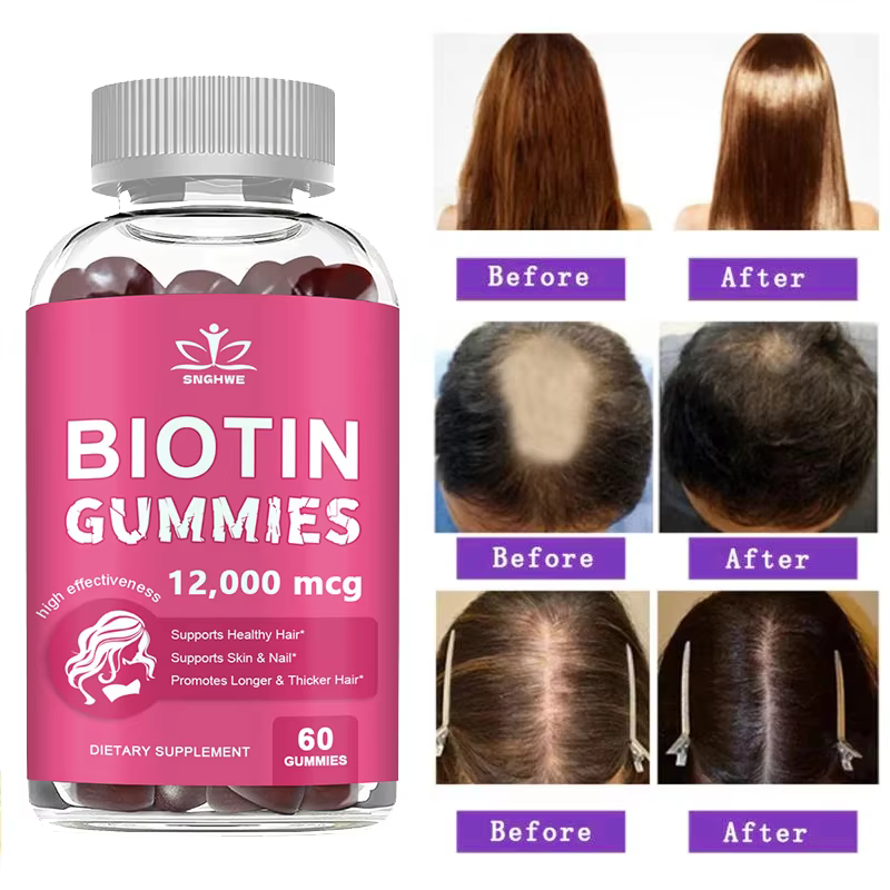 Collagen Gummies Biotin Gummies for Skin Care Health Nails Hair Growth Vitamins Collagen Protein Supplement